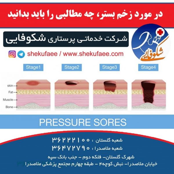 در مورد زخم بستر ، چه مطالبی را باید بدانید 5 درمورد زخم بستر چی میدانید زخم بستر شرکت خدماتی شرکت خدماتی پرستاری پرستار سالمند پرستار سالمند در منزل پرستار پرستاری