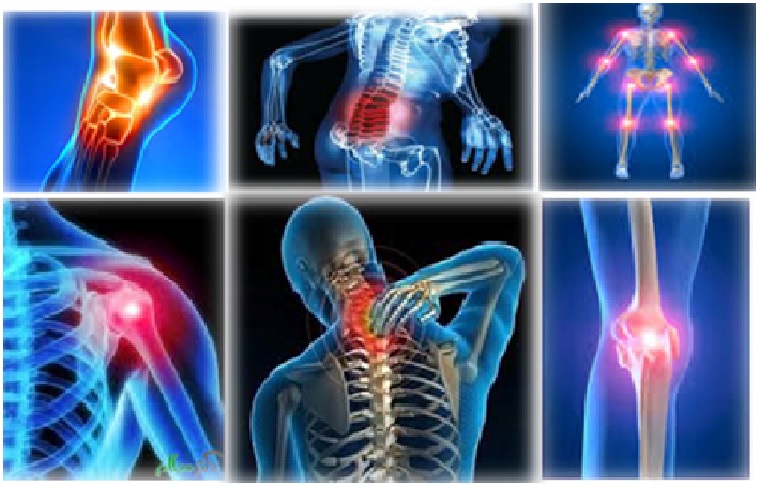 پیشگیری از مشکلات اسکلتی-عضلانی
