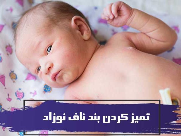 سیزده راه ساده برای تمیز کردن بند ناف نوزاد (2) 5 سیزده راه ساده برای تمیز کردن بند ناف نوزاد (2)