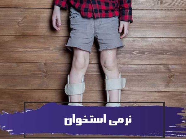 نرمی استخوان 4 نرمی استخوان