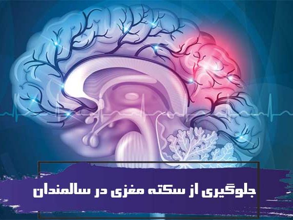 جلوگیری از سکته مغزی در سالمندان 4 جلوگیری از سکته مغزی در سالمندان