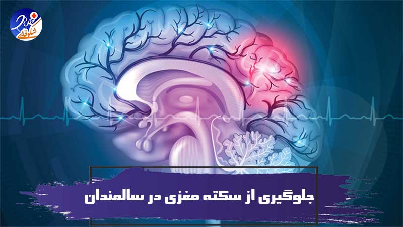 جلوگیری از سکته مغزی در سالمندان 1 جلوگیری از سکته مغزی در سالمندان