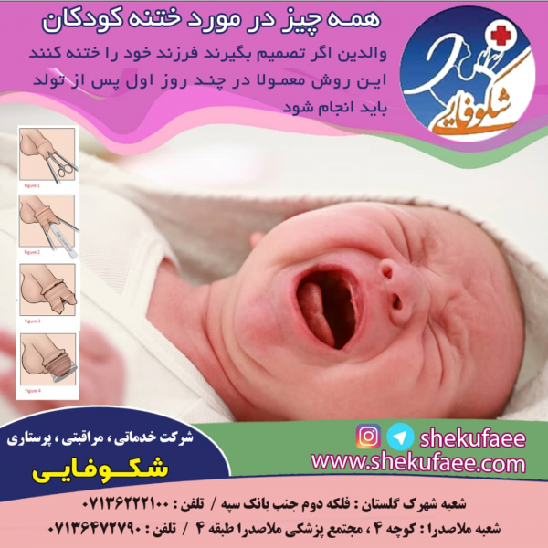ختنه کودکان و نکات قابل توجه 1 در باره ختنه ن زادن انچه لازم است بدانیم شرکت خدماتی شکوفایی