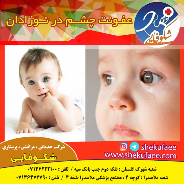 عفونت چشم در نوزادان دلایل و راه حل ها 1 عفونت چشم در نوزادان پرستاری در منزل شرکت خدماتی پرستاری شکوفایی