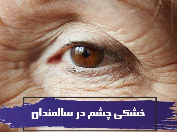 خشکی چشم در سالمندان و روشهای درمان آن 1 خشکی چشم در سالمندان و روشهای درمان آن