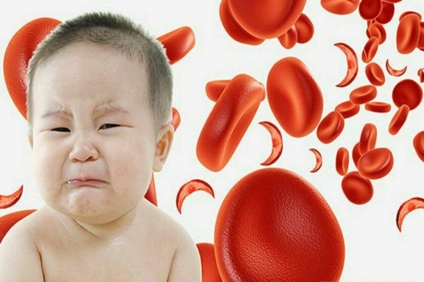 کم خونی در کودکان بسته به نوع بیماری و علت آن، روش درمان آن نیز تغییر می‌کند.