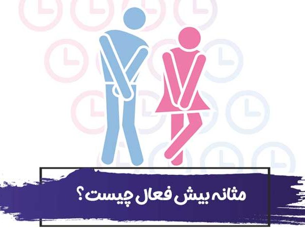 مثانه بیش فعال چیست؟ علت ایجاد مثانه بیش فعال در کودکان، زنان و مردان 14 مثانه بیش فعال چیست؟ علت ایجاد مثانه بیش فعال در کودکان، زنان و مردان