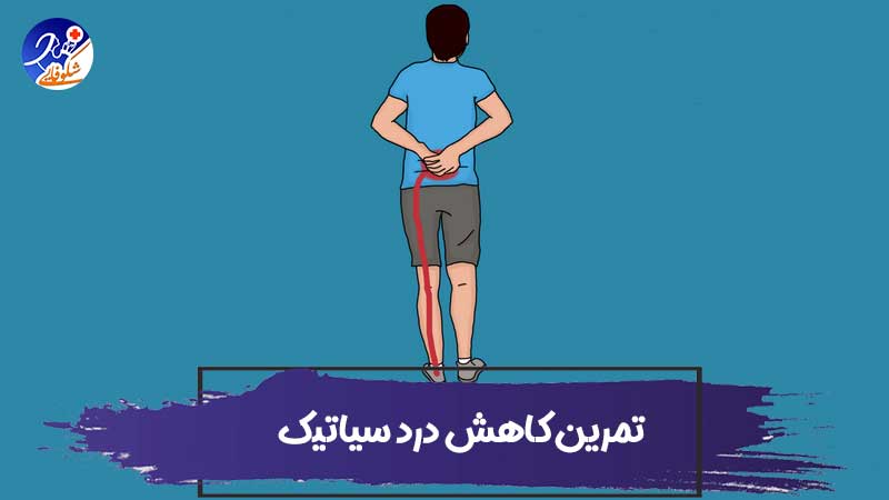 5 تمرین کاهش درد سیاتیک (به همراه تصویر)