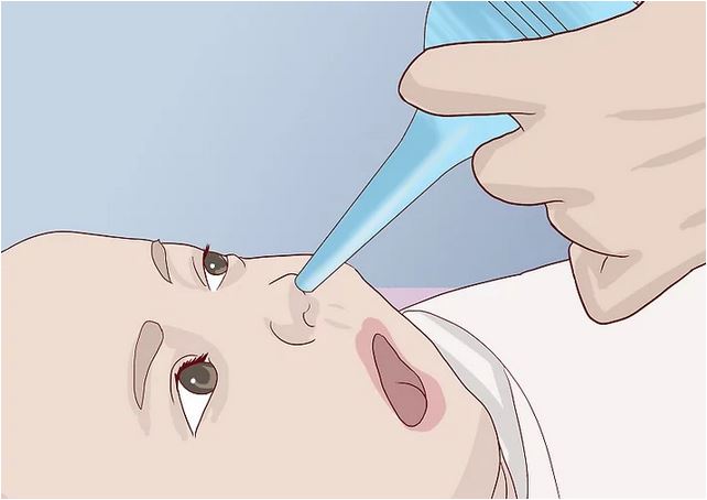 پوار بینی چیست؟ نحوه استفاده از پوار بینی در نوزادان به صورت تصویری
