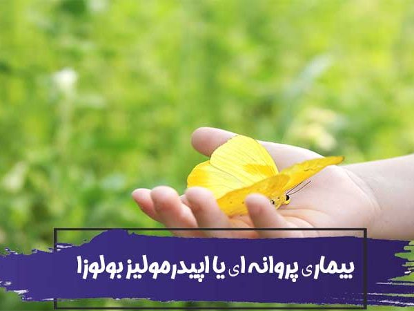 بیماری پروانه ای یا اپیدرمولیز بولوزا (EB) در کودکان 3 بیماری پروانه ای یا اپیدرمولیز بولوزا (EB) در کودکان