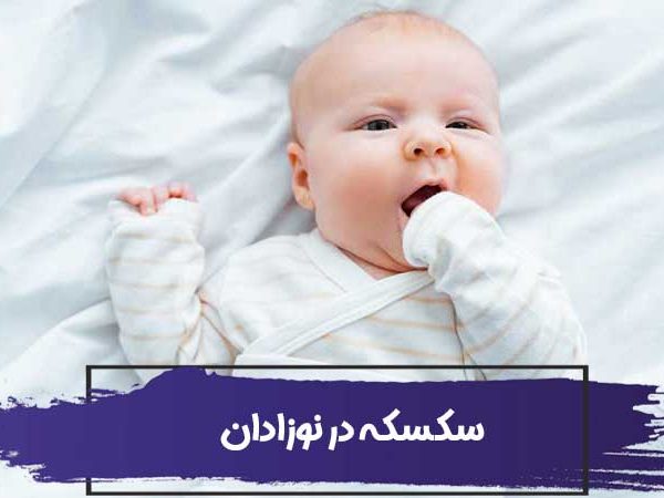 چگونه جلوی سکسکه در نوزادان را بگیریم؟ 1 چگونه جلوی سکسکه در نوزادان را بگیریم؟