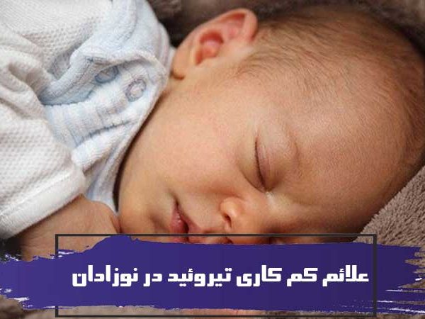 علائم کم کاری تیروئید در نوزادان 1 علائم کم کاری تیروئید در نوزادان