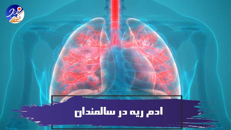 Pulmonary oedema 1
