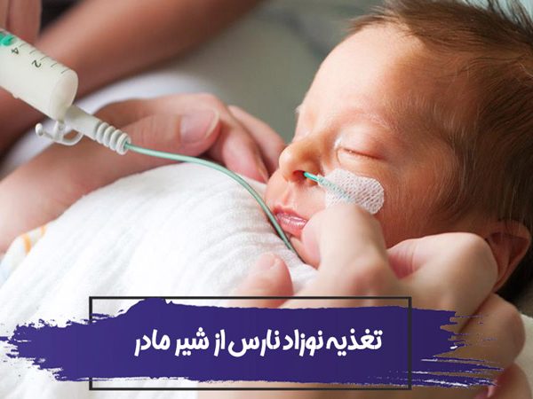 شیر دادن به نوزاد نارس : آیا تغذیه نوزاد نارس از شیر مادر اشتباه است؟ 10 شیر دادن به نوزاد نارس : آیا تغذیه نوزاد نارس از شیر مادر اشتباه است؟