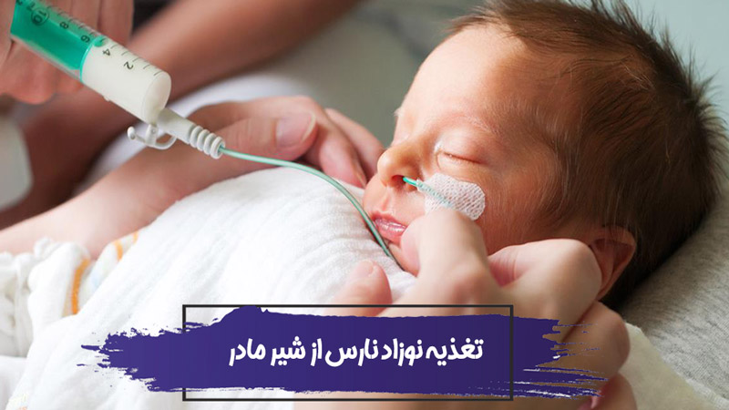 شیر دادن به نوزاد نارس : آیا تغذیه نوزاد نارس از شیر مادر اشتباه است؟