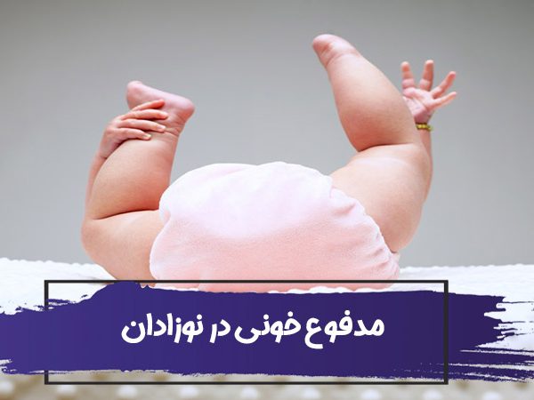 علت و درمان مدفوع خونی نوزاد : وجود رگه های خونی و خلط خونی در مدفوع 8 علت و درمان مدفوع خونی نوزاد : وجود رگه های خونی و خلط خونی در مدفوع