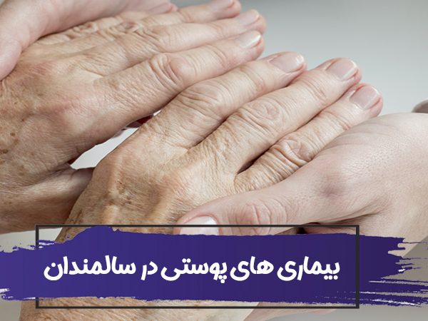 بیماری های رایج پوستی در سالمندان 1 بیماری های رایج پوستی در سالمندان