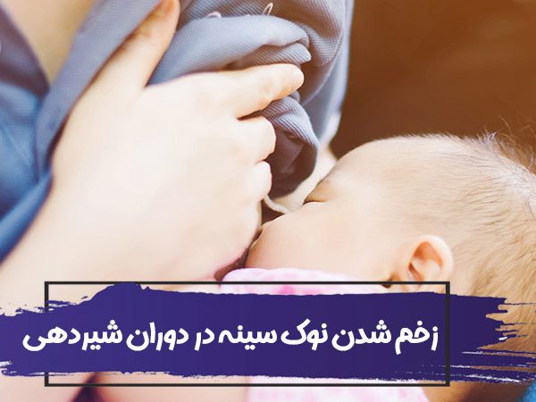 علت شقاق نوک سینه : درمان زخم شدن نوک سینه در دوران شیردهی 7 علت شقاق نوک سینه : درمان زخم شدن نوک سینه در دوران شیردهی