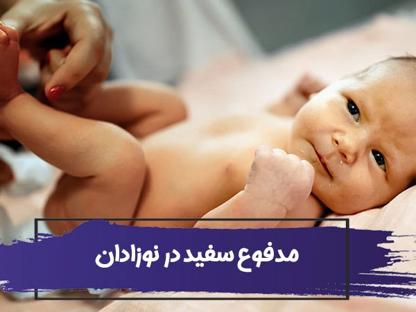 علت مدفوع نوزاد با تکه های سفید رنگ : آیا باید کودکم را دکتر ببرم؟ 1 علت مدفوع نوزاد با تکه های سفید رنگ : آیا باید کودکم را دکتر ببرم؟