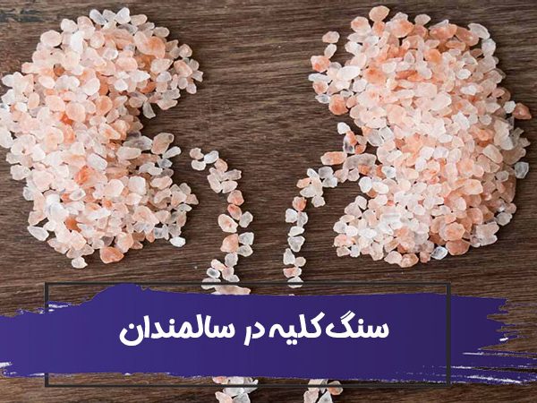 سنگ کلیه چیست؟ انواع سنگ کلیه در سالمندان 1 سنگ کلیه چیست؟ انواع سنگ کلیه در سالمندان