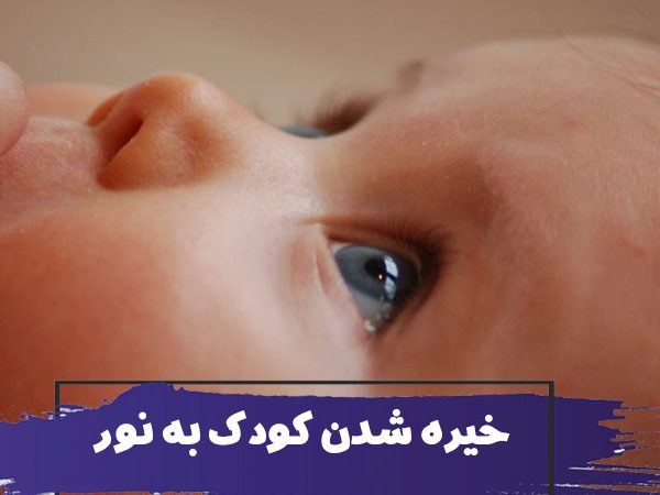 چرا کودکان به نور خیره میشوند؟ 2 چرا کودکان به نور خیره میشوند؟