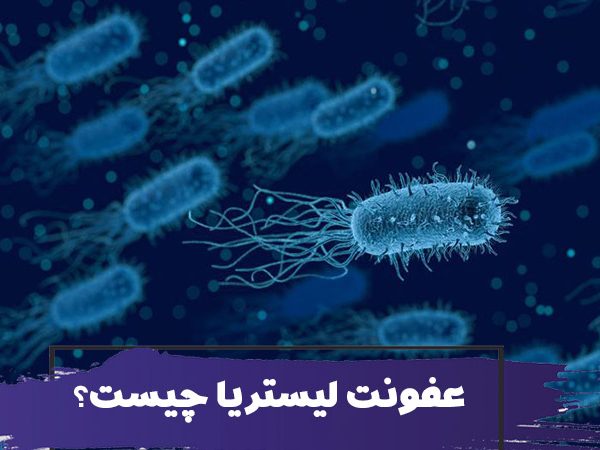 آیا عفونت لیستریا برای سالمندان و کودکان خطرناک است؟ علائم، علل، تشخیص و درمان لیستریا 5 آیا عفونت لیستریا برای سالمندان خطرناک است؟ علائم، علل، تشخیص و درمان لیستریا