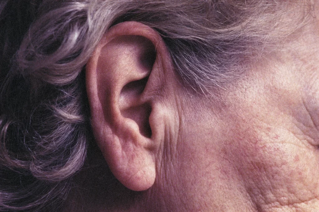 عفونت گوش در سالمندان : علل و عوامل خطر، علائم، تشخیص و پیشگیری