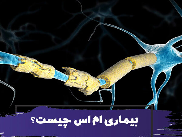 مولتیپل اسکلروزیس چیست؟ علت، علائم و نحوه تشخیص و درمان ام اس 1 مولتیپل اسکلروزیس چیست؟ علت، علائم و نحوه تشخیص و درمان ام اس