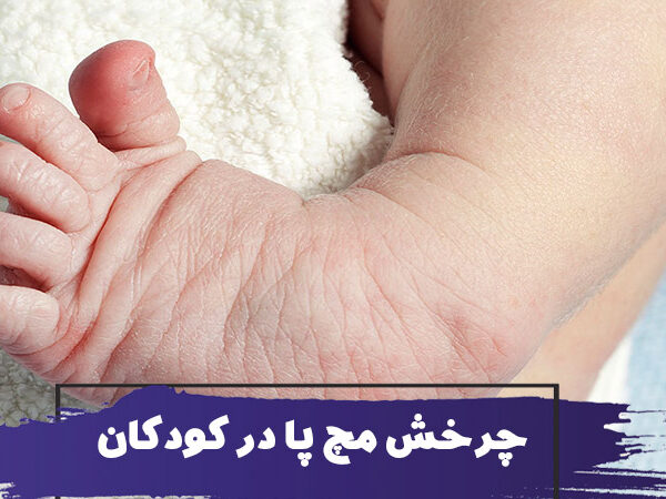 پا اردکی و پنجه کبوتری چیست؟ علت چرخش مچ پای کودکان به داخل و خارج 10 پا اردکی و پنجه کبوتری چیست؟ علت چرخش مچ پای کودکان به داخل و خارج