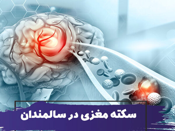 سکته مغزی در سالمندان 6 سکته مغزی در سالمندان