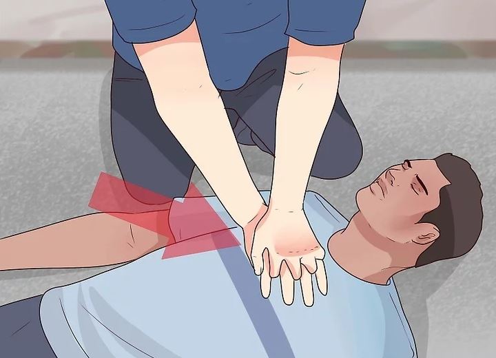 نحوه ارزیابی سطح هوشیاری در طول کمک های اولیه 19 دادن CPR به یک فرد بدون نبض