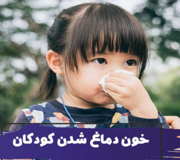 خون دماغ شدن در کودکان