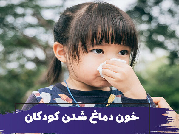 خون دماغ شدن در کودکان