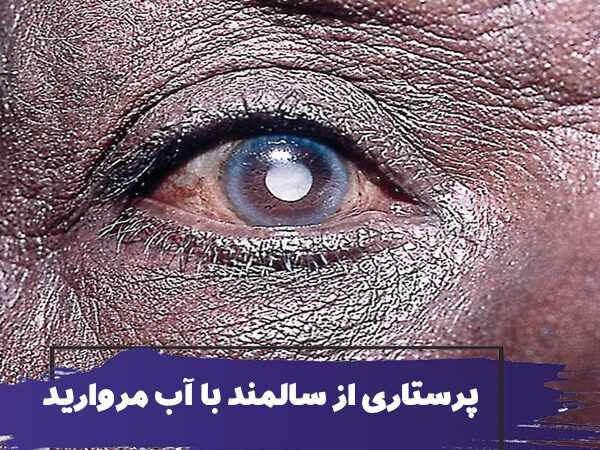 نحوه مراقبت و پرستاری از سالمند با آب مروارید