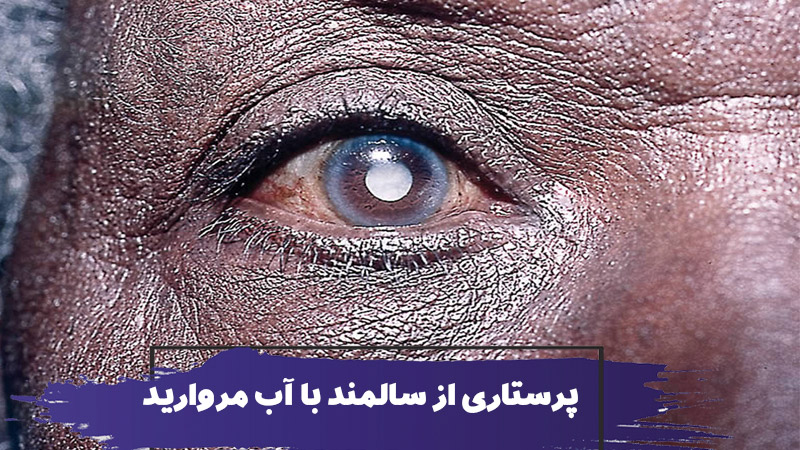 نحوه مراقبت و پرستاری از سالمند با آب مروارید