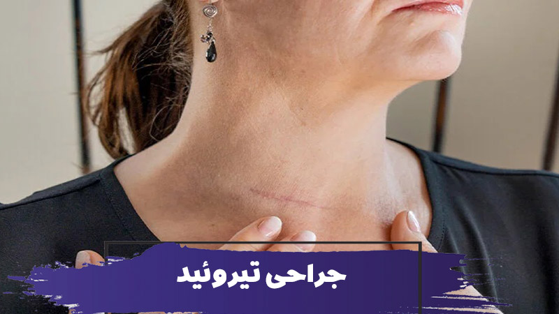 پرستاری از سالمند بعد از جراحی تیروئید 1 پرستاری از سالمند بعد از جراحی تیروئید