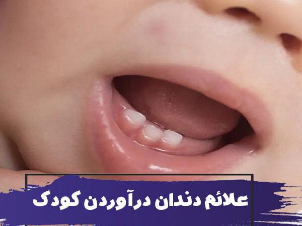 علائم دندان درآوردن کودکان 5 علائم دندان درآوردن کودکان
