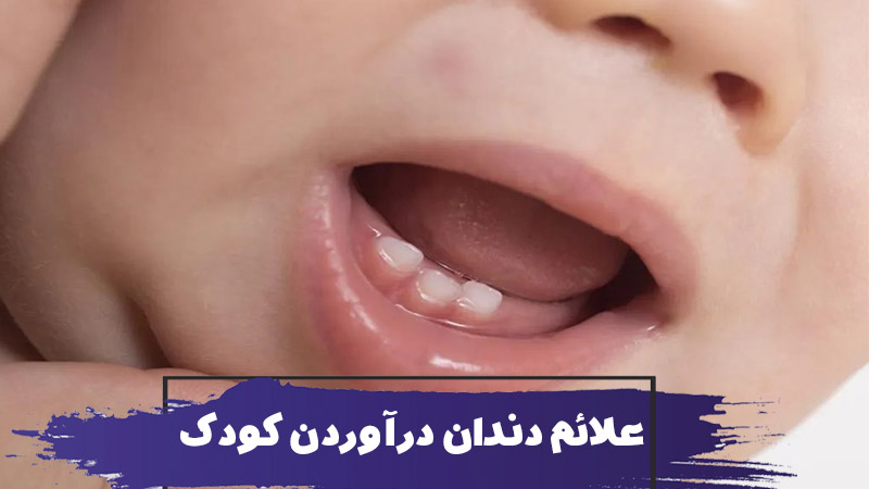علائم دندان درآوردن کودکان 1 علائم دندان درآوردن کودکان