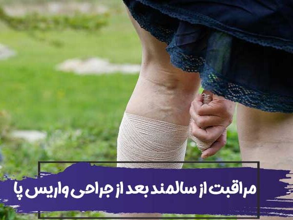 مراقبت از سالمند بعد از جراحی واریس پا 9 مراقبت از سالمند بعد از جراحی واریس پا