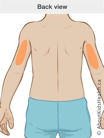 نحوه تزریق انسولین به سالمندان دیابتی 4 نحوه تزریق انسولین به سالمندان دیابتی