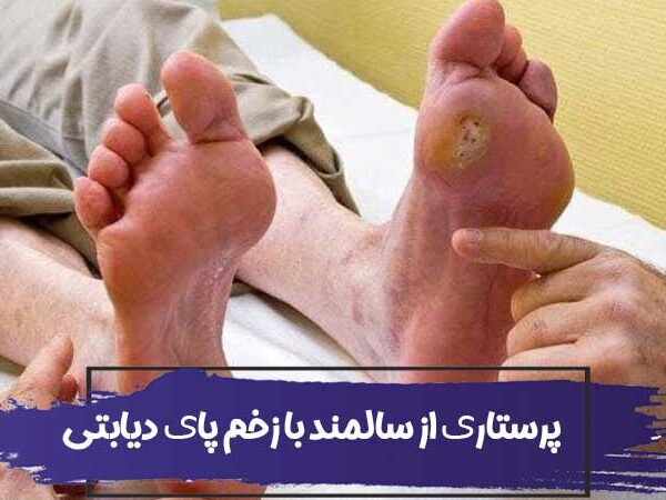 پرستاری از سالمند با زخم پای دیابتی