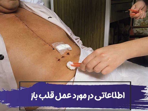 عمل قلب باز چیست؟ تا چند سال بعد از جراحی زنده می مانم؟