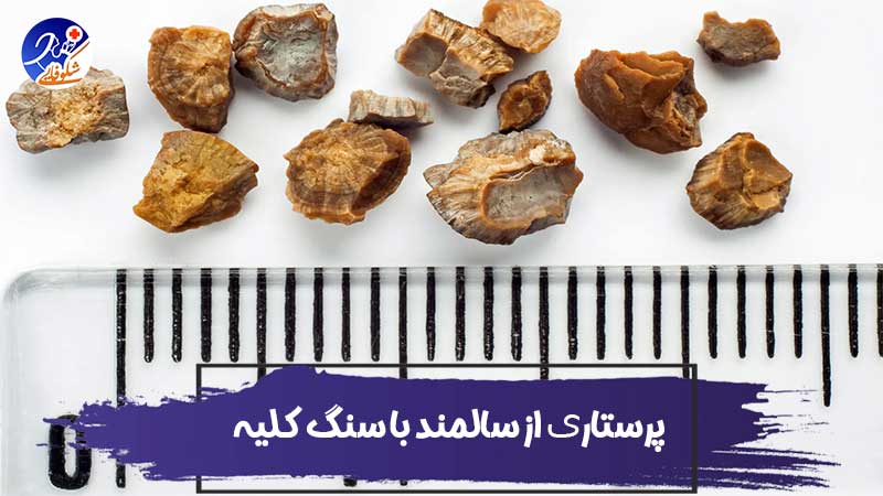 پرستاری و مراقبت از سالمند با سنگ کلیه 1 پرستاری و مراقبت از سالمند با سنگ کلیه